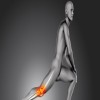  Journal of Aging Research and Healthcare - Osteoarthritis Falls